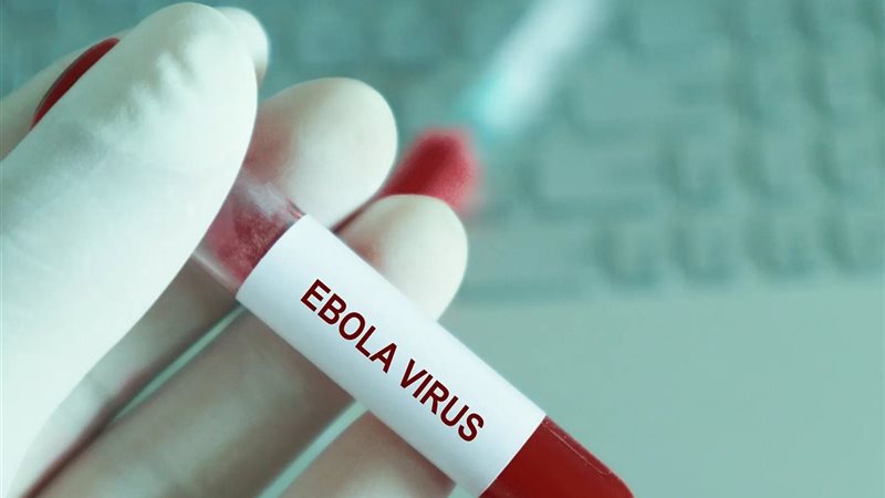 فرنسا تعلن تسجيل أول إصابة مؤكدة بفيروس إيبولا